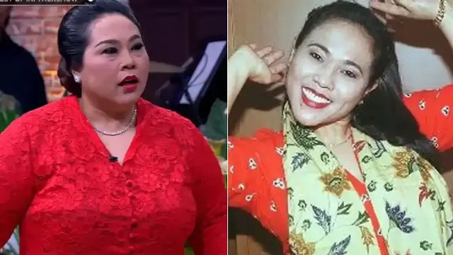 Nunung Akui Pernah Pasang Susuk di Usia 17 Tahun, Ini Alasannya