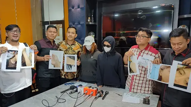 Korban Ungkap Kronologi Dugaan Kekerasan Seksual dan Penganiayaan di Kelab SCBD, Sebut Ada Pemaksaan Dari Betrand Peto