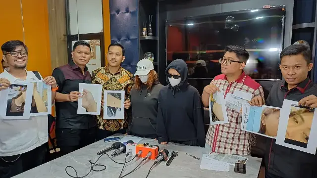 Besok Diperiksa Polda Metro Jaya, Korban Kasus BP Bawa Bukti Luka Cakaran