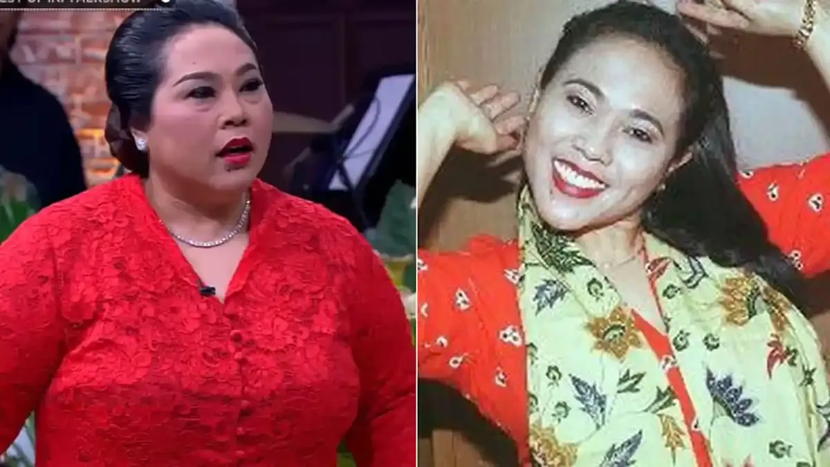 Nunung Akui Pernah Pasang Susuk di Usia 17 Tahun, Ini Alasannya